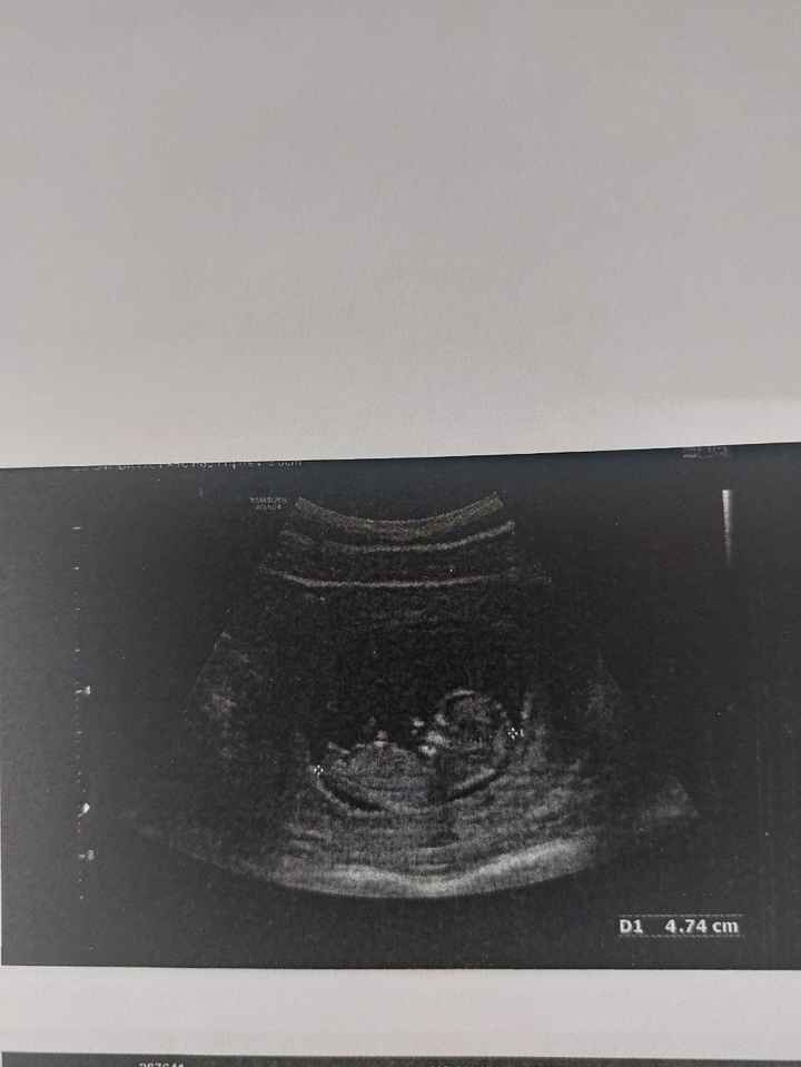 Nub theory 😂😂😂😂 - 1