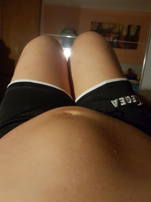 Diastasi addominale ( bozzo sull addome) - 1