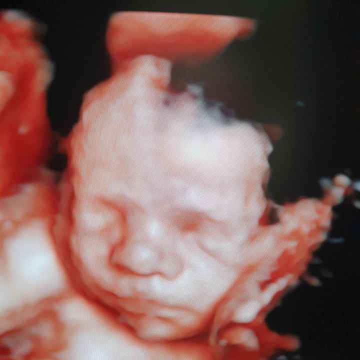 Future mamme Agosto 2021! - 1
