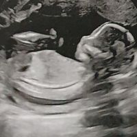 Future mamme Agosto 2021! - 1