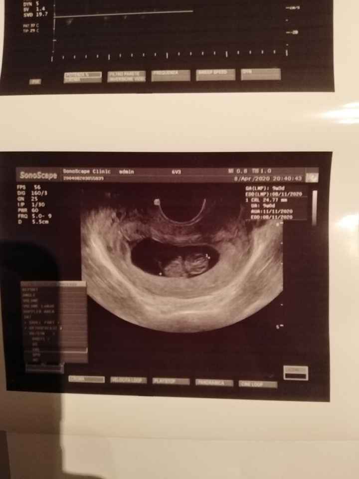 Qualcuna brava metodo ramziiii??? - 1