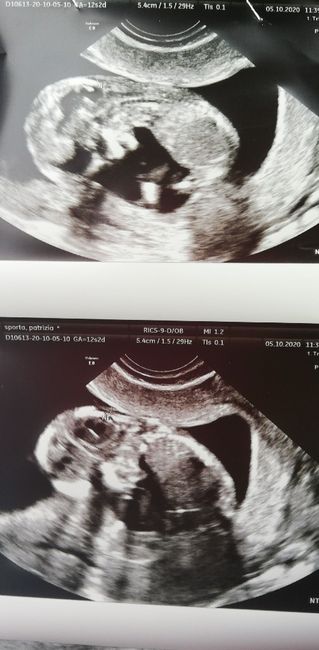 Future mamme di Aprile 2021 🐣 - 1