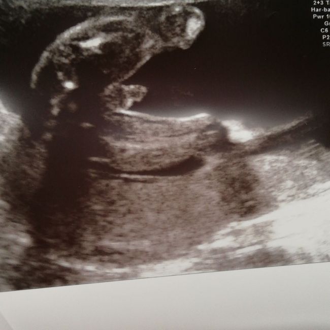 Future mamme di Aprile 2021 🐣 - 1