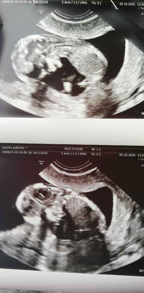 Future mamme di Aprile 2021 🐣 - 1