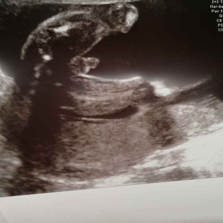 Future mamme di Aprile 2021 🐣 - 1