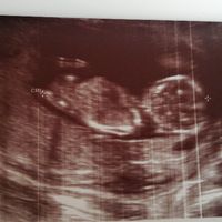 Metodo Ramzi eco 10+1 - 1