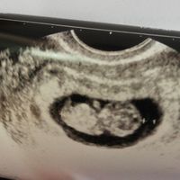 Metodo Ramzi eco 10+1 - 1