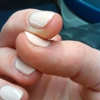 L'estetista mi ha rovinato le mani - 3