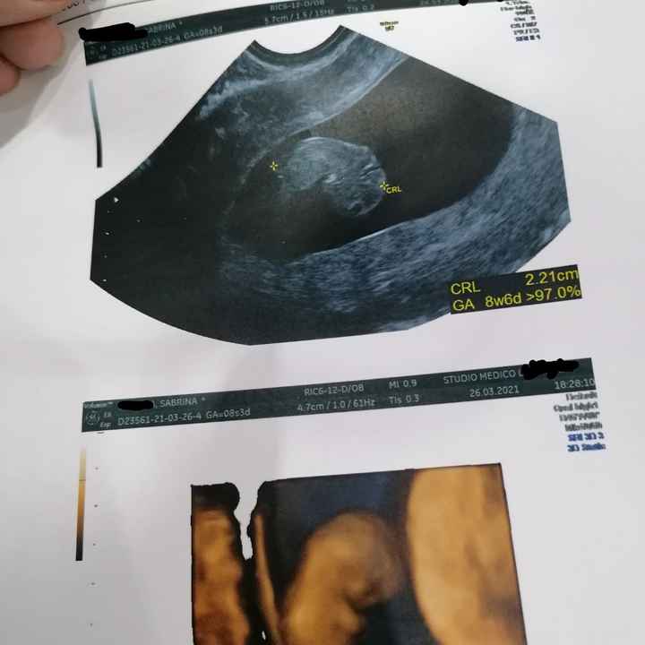 Future mamme novembre 2021 - 1