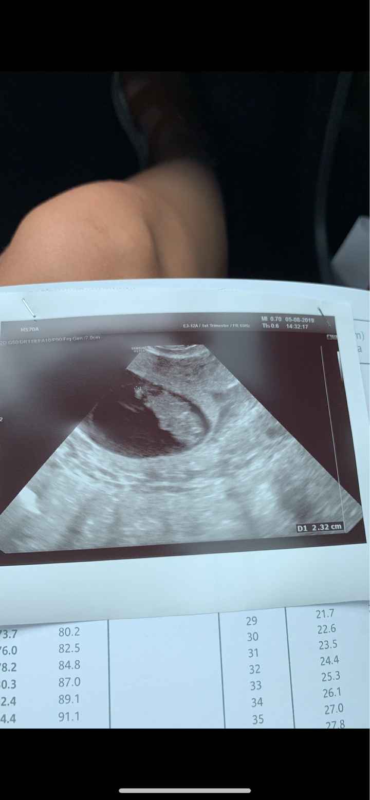 Maschietto o femminuccia? - 1