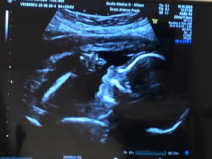 Future mamme Marzo 2021 - 1