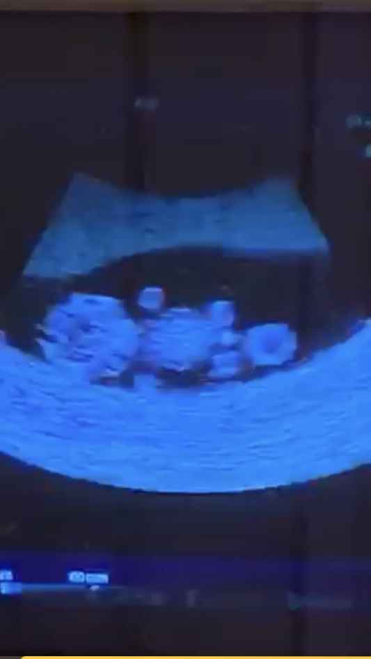 Future mamme Marzo 2021 - 1