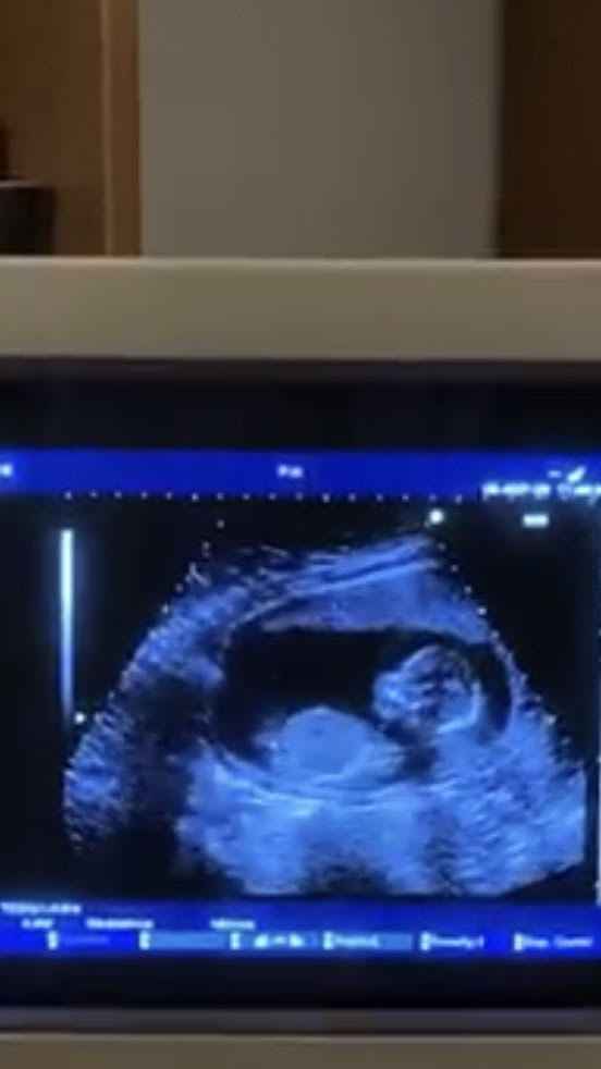 Future mamme Marzo 2021 - 1