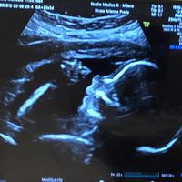 Future mamme Marzo 2021 - 1