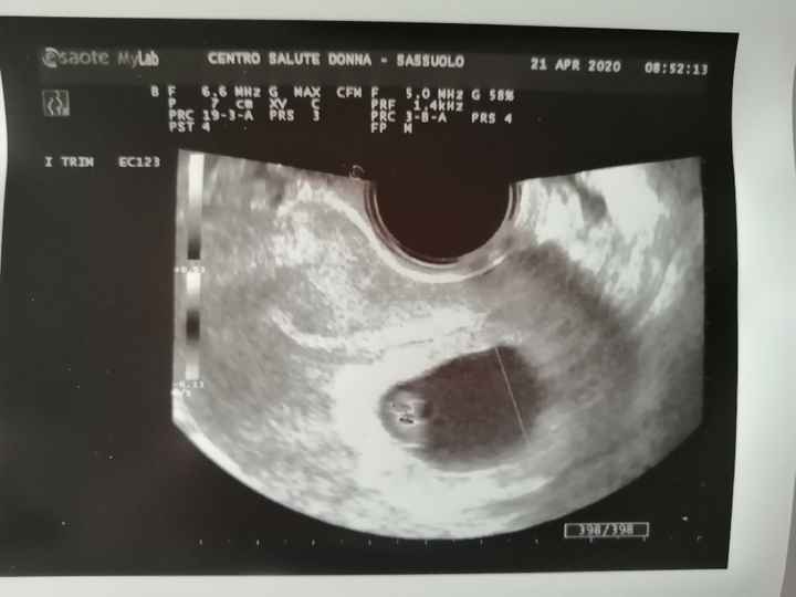 Metodo Ramzi... sfatiamo il mito? 💙 o 💖 - 1