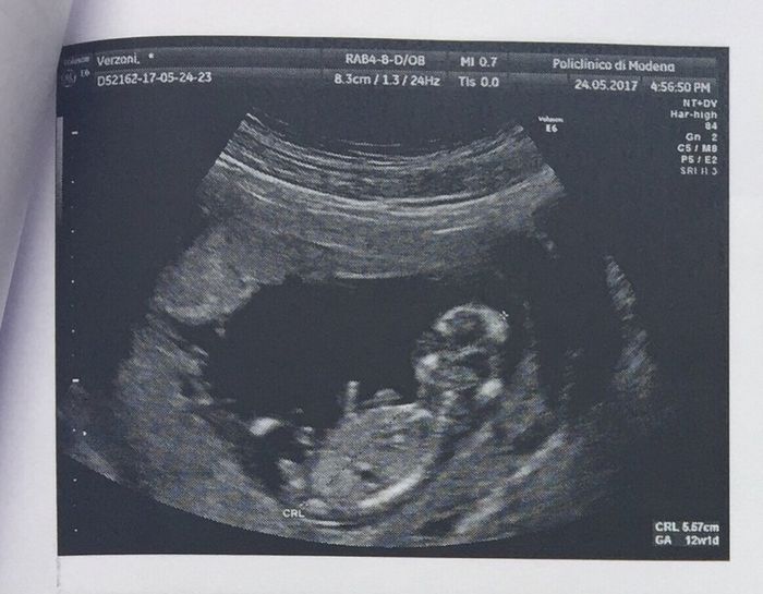 Eco translucenza... perfetta 😍😇 1