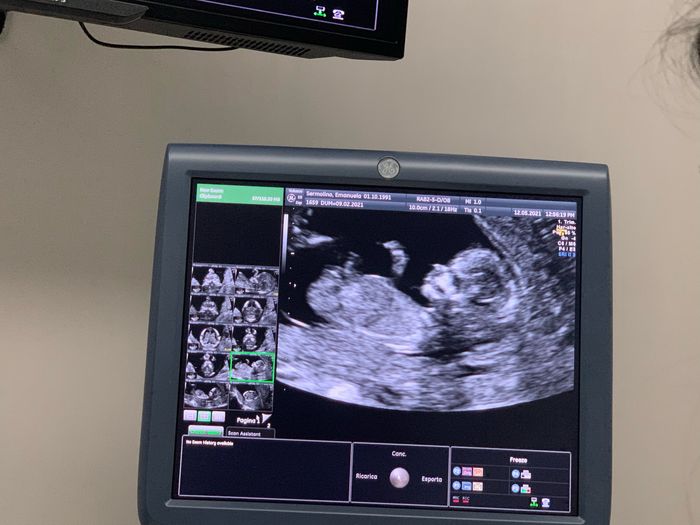 Future mamme novembre 2021 - 2