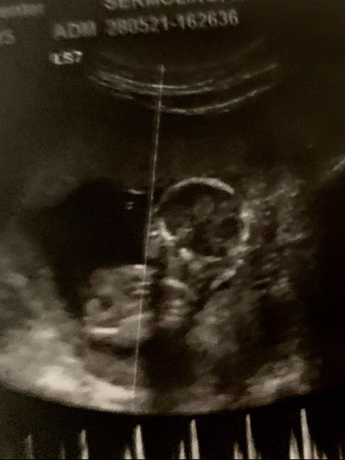 Future mamme novembre 2021 - 1