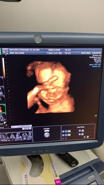 Future mamme novembre 2021 - 1