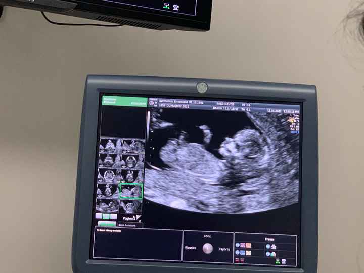 Future mamme novembre 2021 - 2