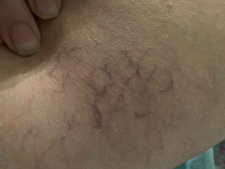 Future mamme novembre 2021 - 1