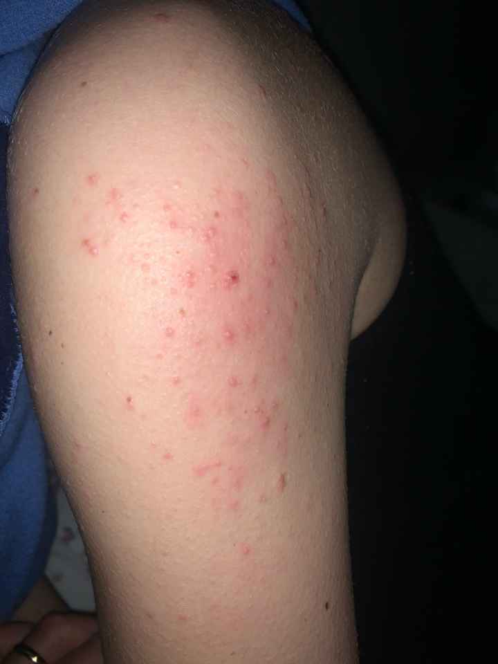 Aiuto 😢😢😢😢 - 1