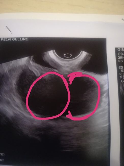 Non sò se potete aiuarmi... 1