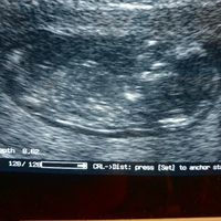 Esperte di Nub Theory a me - 1