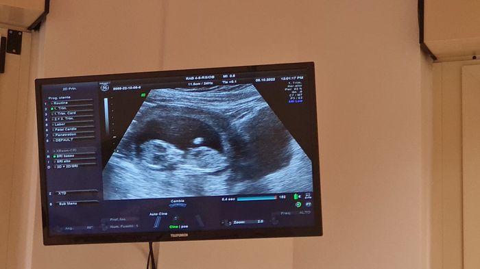 Future mamme di aprile 2023 1