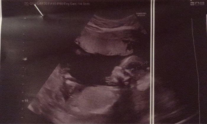 Future mamme Agosto 2021! - 1