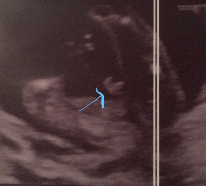 Future mamme Agosto 2021! - 2