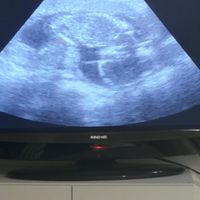 Future mamme luglio 2023 - 1