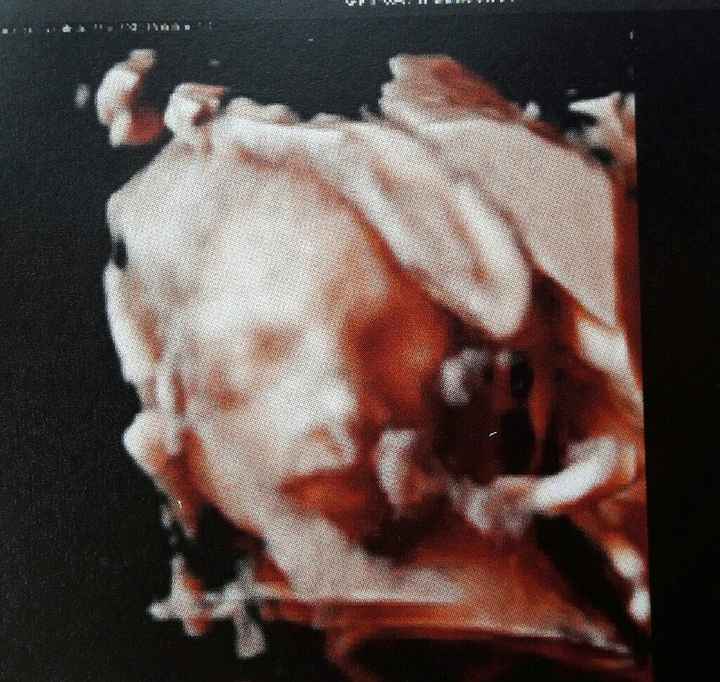 L'emozione della morfologica - 1