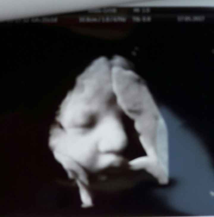 Ansia ed emozione... si avvicina il parto! - 1