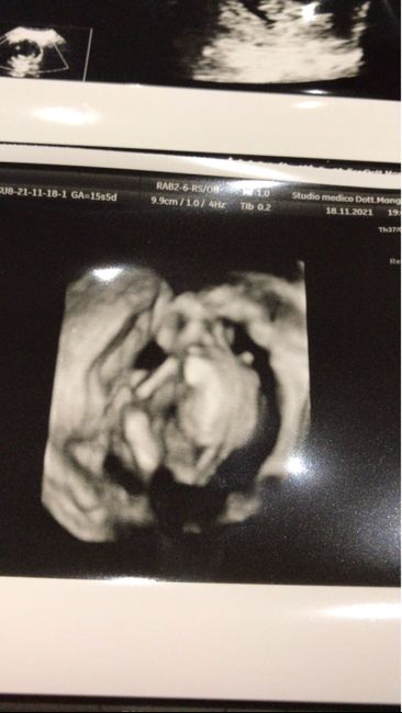 💙💜future mamme di Maggio 2022💙💜 - 1