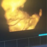 💙💜future mamme di Maggio 2022💙💜 - 1