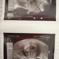 Metodo Ramzi... sfatiamo il mito? 💙 o 💖 - 1