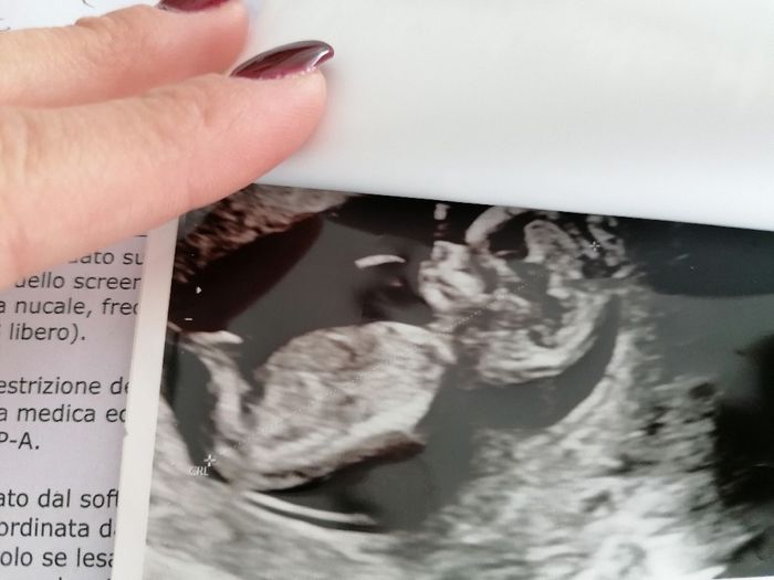 Future mamme di Aprile 2021 🐣 - 1