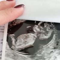 Future mamme di Aprile 2021 🐣 - 1