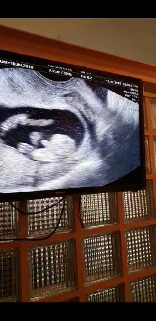 Maschio o femmina? - 1