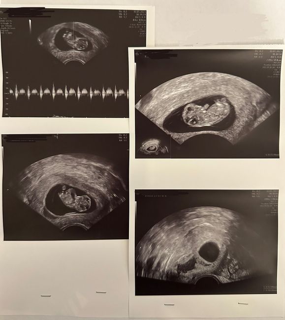 Future mamme Dicembre 2023 1