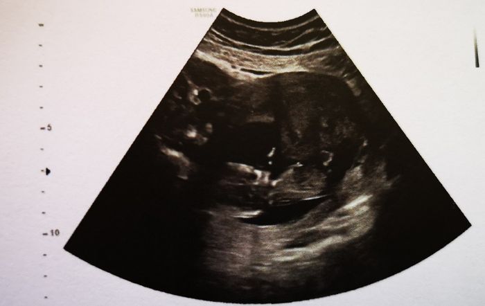 Future mamma settembre 2019 - 1