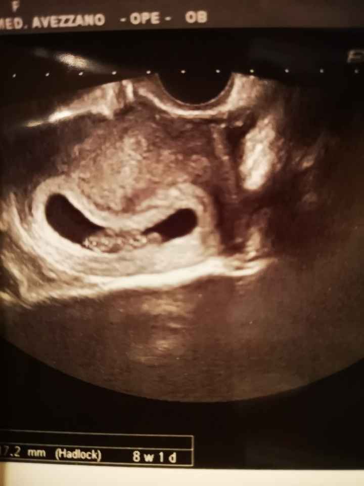 Prima eco , mi preoccupo?! - 1