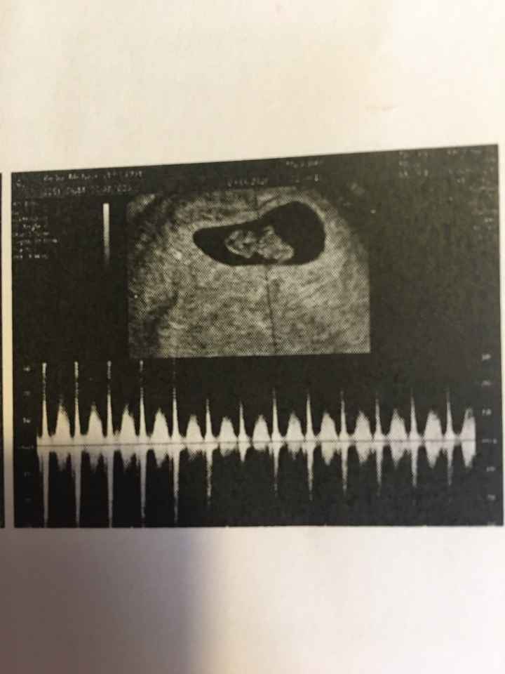 Mammine di gennaio 2021 - 1