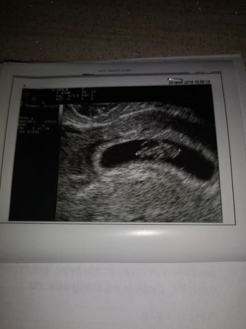 Prima eco , mi preoccupo?! - 1