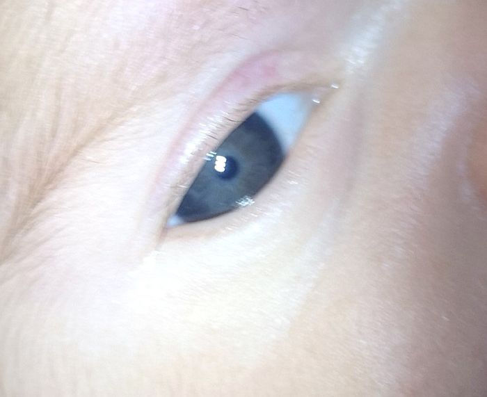 Colore occhi neonato: azzurri o castani? Esperienze cercasi!!!! 11