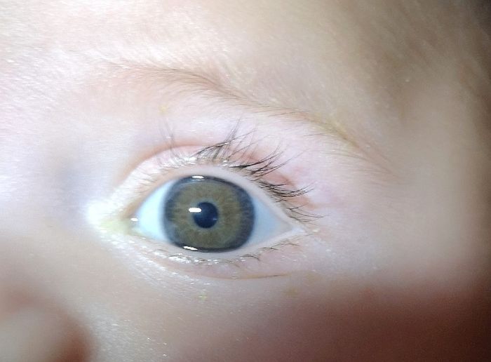 Colore occhi neonato: azzurri o castani? Esperienze cercasi!!!! 12