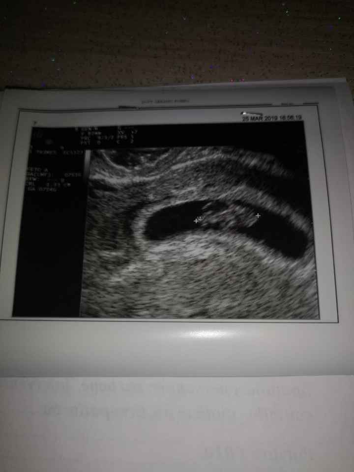 Prima eco , mi preoccupo?! - 1