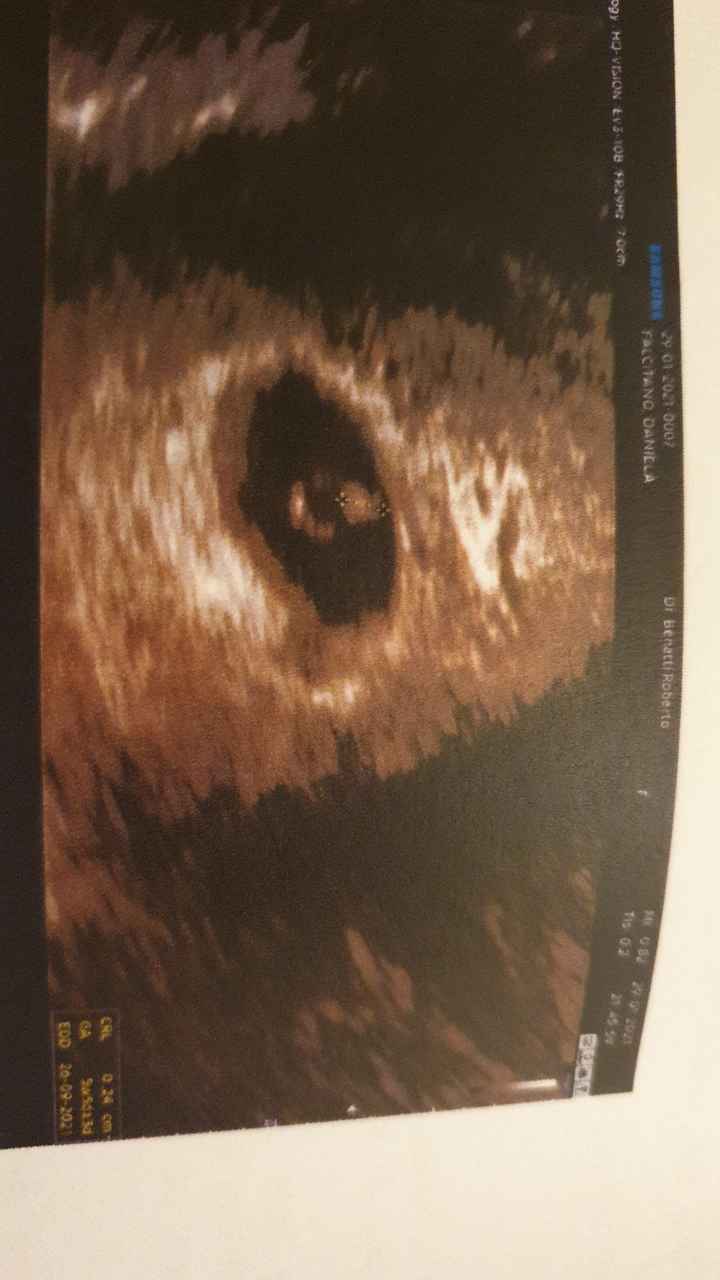 Future Mamme Settembre 2021😍 - 1