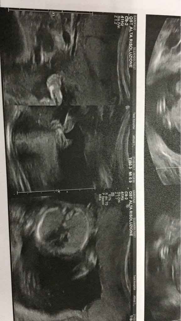 Morfologica e un po' di pensieri - 1